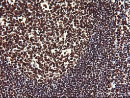 NONO / P54NRB Antibody (clone OTI3F8)