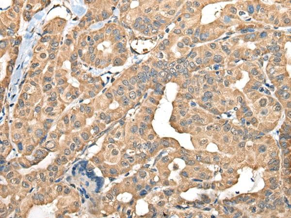 FAM110B / C8orf72 Antibody