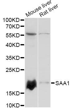 SAA1 / SAA / Serum Amyloid A Antibody