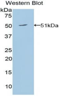 EPO / Erythropoietin Antibody (aa27-194)