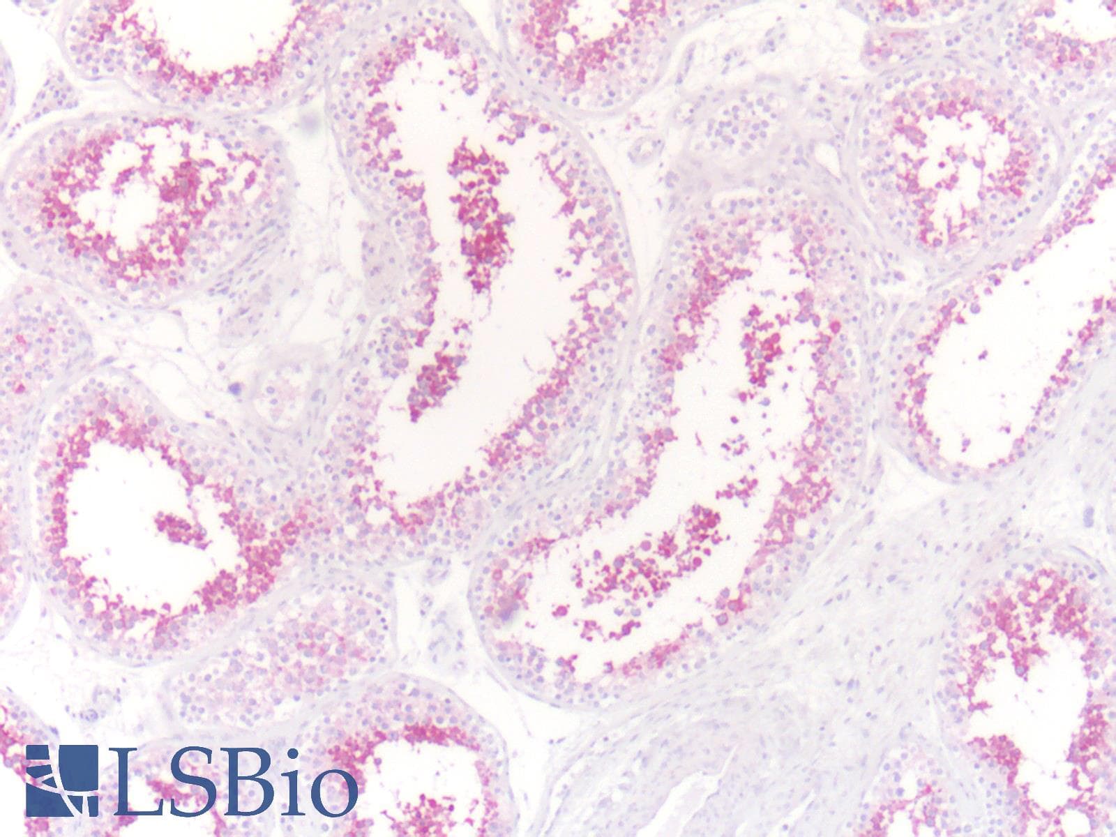 IHC-plus™ WNT5B Antibody (Internal)