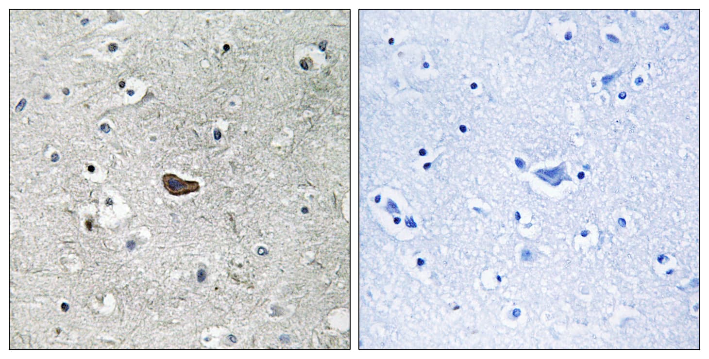 PRKCD / PKC-Delta Antibody (aa612-661)