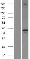 LIMS1 / PINCH Protein (Over-Expression Lysate Myc-DDK (Flag))