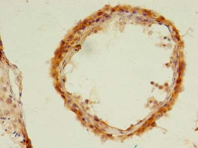 UBLCP1 Antibody
