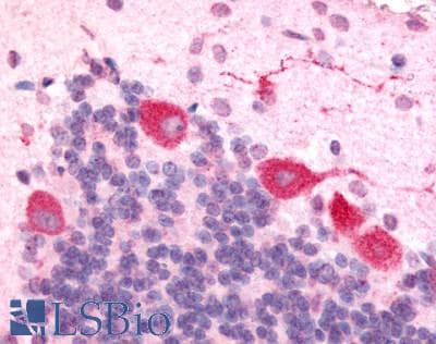 IHC-plus™ OX1R / Orexin Receptor 1 Antibody (Cytoplasmic Domain)