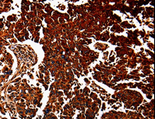 ANXA7 / Annexin VII / SNX Antibody