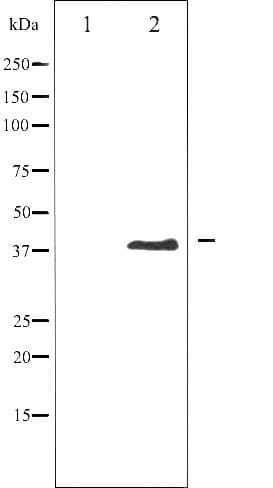 AURKB / Aurora-B Antibody (phospho-Thr232)