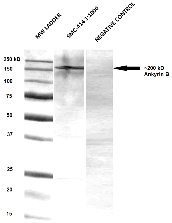 IHC-plus™ ANK2 / Ankyrin B Antibody (aa203-496, clone S105-17)