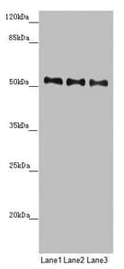 Polyclonal Rabbit anti-Human PMPCB / MPP11 Antibody (IHC, WB)