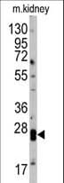 CLDN1 / Claudin 1 Antibody (aa122-163)