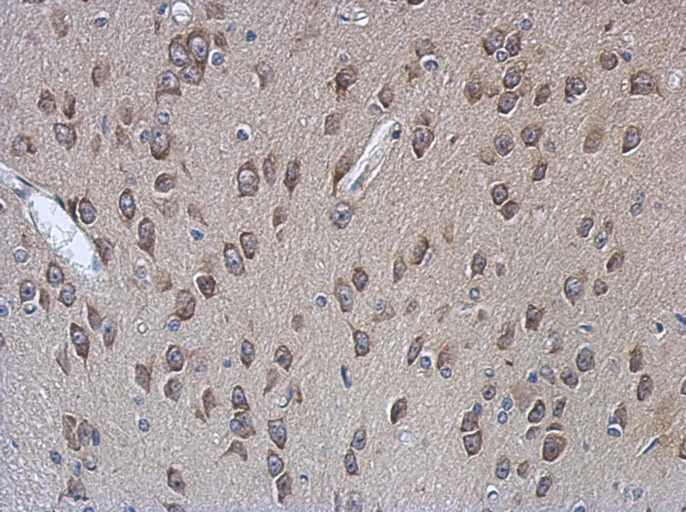 Polyclonal Rabbit anti-Human PABPC4 Antibody (IHC, WB)