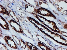 PSMB9 Antibody (clone OTI1G7)