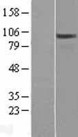 OSBPL3 Protein (Over-Expression Lysate Myc-DDK (Flag))