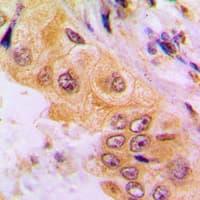 Polyclonal Rabbit anti-Human CYP2A7 Antibody (C-Terminus, IHC, WB)