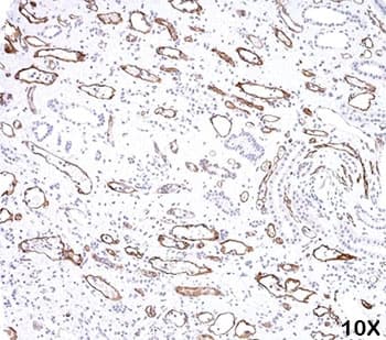 Complement C4d Antibody (clone C4D204)