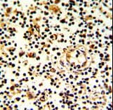 KLRD1 / CD94 Antibody (aa31-57)