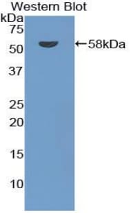 ACKR1 / DARC Antibody (aa71-330)