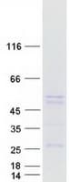Human PLIN2 / ADFP / Adipophilin Protein (Recombinant Myc-DDK (Flag))