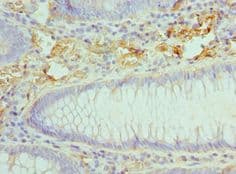 CCL28 / MEC Antibody (aa20-127)