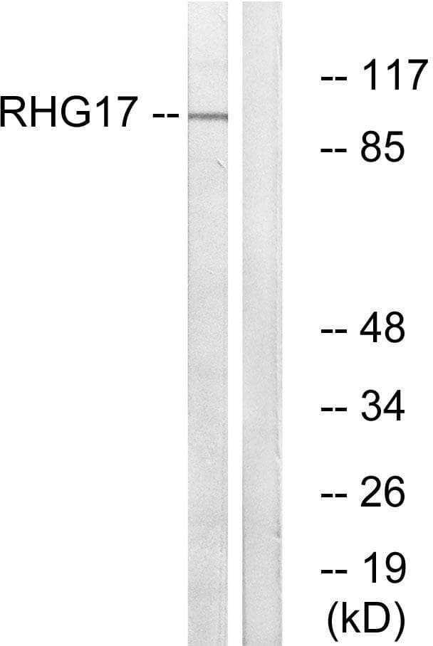 ARHGAP17 / NADRIN Antibody