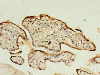 C1QTNF6 / CTRP6 Antibody