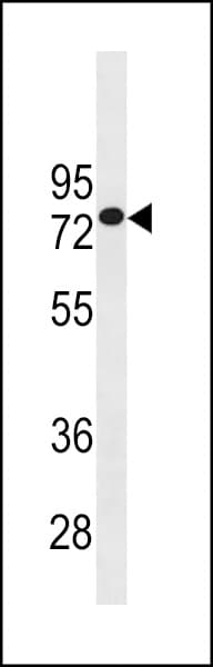 Polyclonal Rabbit anti-Human GOLGA8J Antibody (aa38-64, WB)
