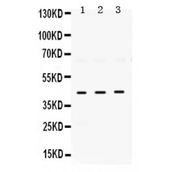 ELAVL4 / HuD Antibody (aa8-45)
