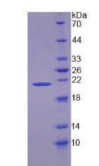 Human ZG16B Protein (Recombinant His-T7)