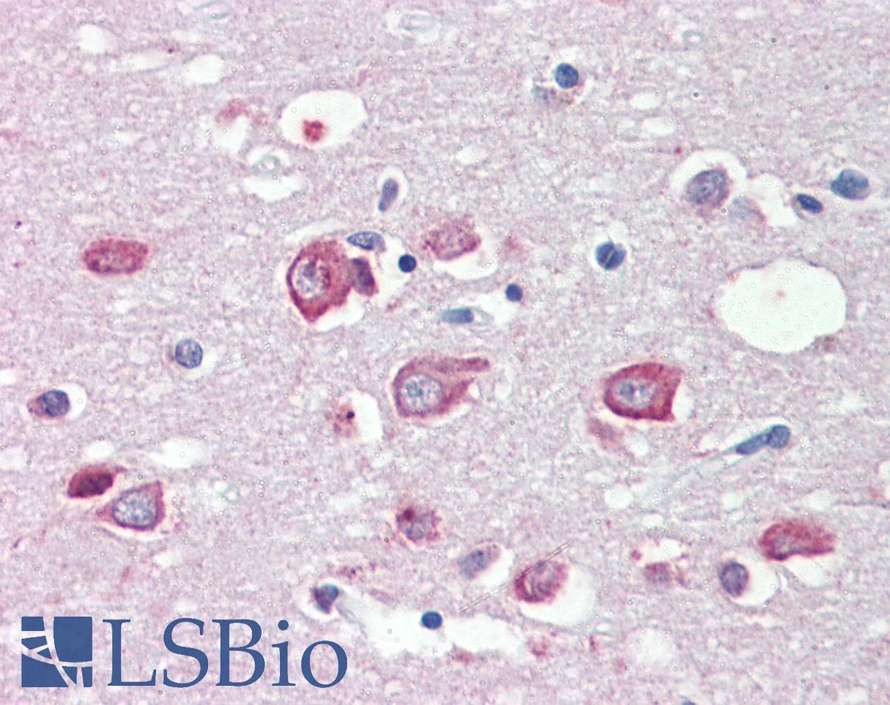 IHC-plus™ Polyclonal Goat anti-Human KMT2B / MLL4 Antibody (aa2703-2715, IHC)