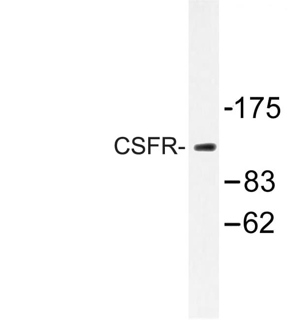 CSF1R / CD115 / FMS Antibody (Asn805)
