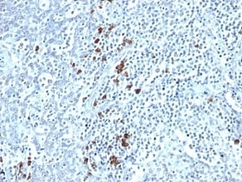 Mouse Anti-Human Kappa Light Chain Secondary Antibody (clone TB28-2, Ready-to-Use)