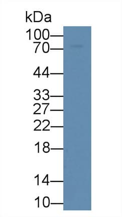 GLB1 / Beta-Galactosidase Antibody (aa338-570, APC)