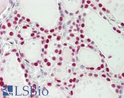 IHC-plus™ Polyclonal Rabbit anti-Human SF3B1 Antibody (aa200-250, IHC)