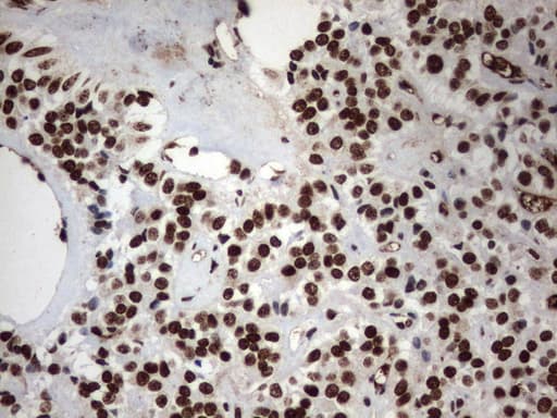 MLF1 Antibody (clone UMAB138)