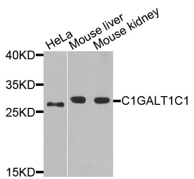 C1GALT1C1 Antibody