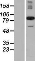 CCPG1 / CRP8 Protein (Over-Expression Lysate Myc-DDK (Flag))