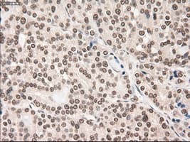 NOTCH1 Antibody (clone OTI3E12)