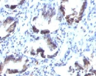 TAGLN / Transgelin / SM22 Antibody (clone SMP22a, Ready-to-Use)
