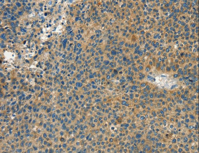 CALCA Antibody