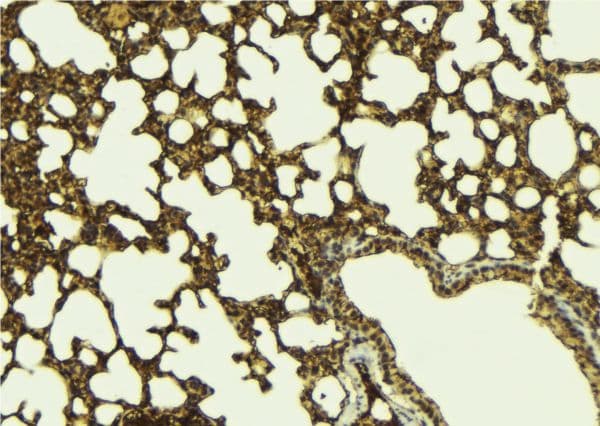ATXN3 / JOS Antibody