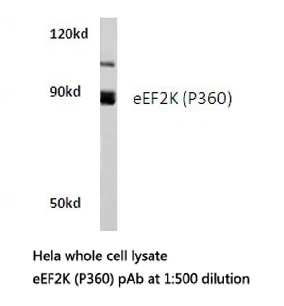 EEF2K Antibody (Pro360)