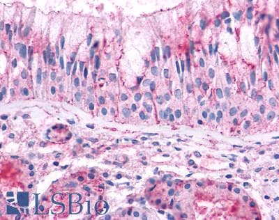 PathPlus™ Polyclonal Rabbit anti-Human OR2A4 Antibody (Extracellular Domain, IHC)