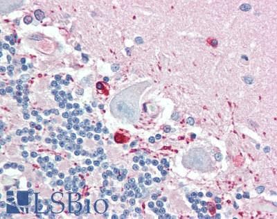 IHC-plus™ Polyclonal Rabbit anti-Human PPP1R14A / CPI-17 Antibody (IHC)