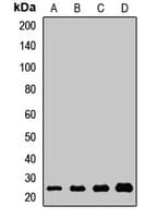 ICT1 / DS1 Antibody
