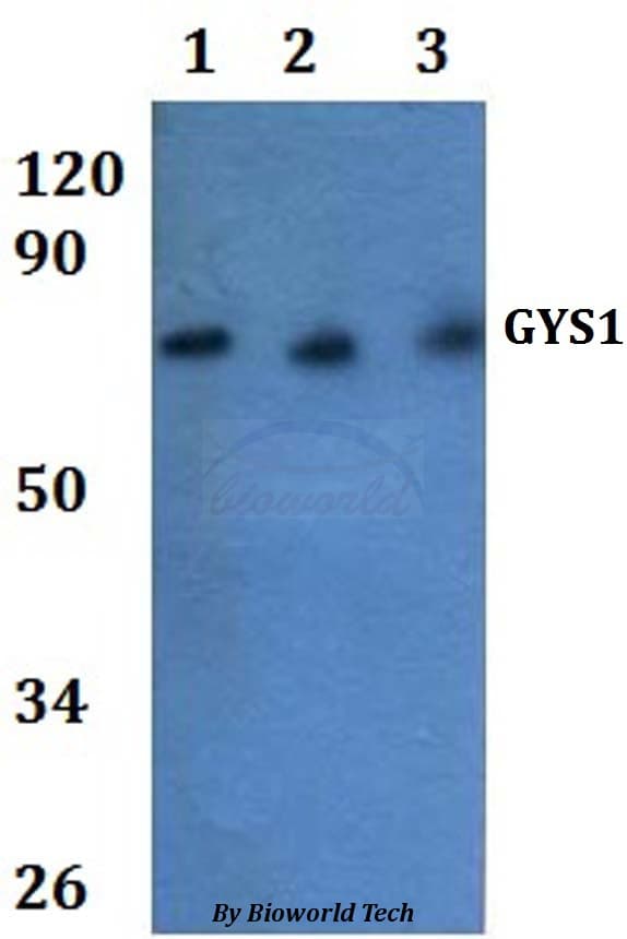 Polyclonal Rabbit anti-Human GYS1 / Glycogen Synthase Antibody (WB)