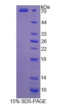 Human SGCA / DAG2 Protein (Recombinant His-GST, N-terminus)