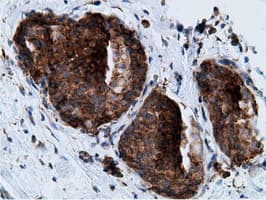 KHK / Ketohexokinase Antibody (clone OTI3D1)