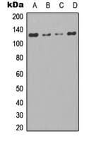 TAOK1 / TAO1 Antibody (Internal)