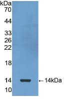CXCL7 / PPBP Antibody (aa59-128)