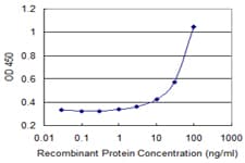 ATP8B1 / BRIC Antibody (clone 3F10)